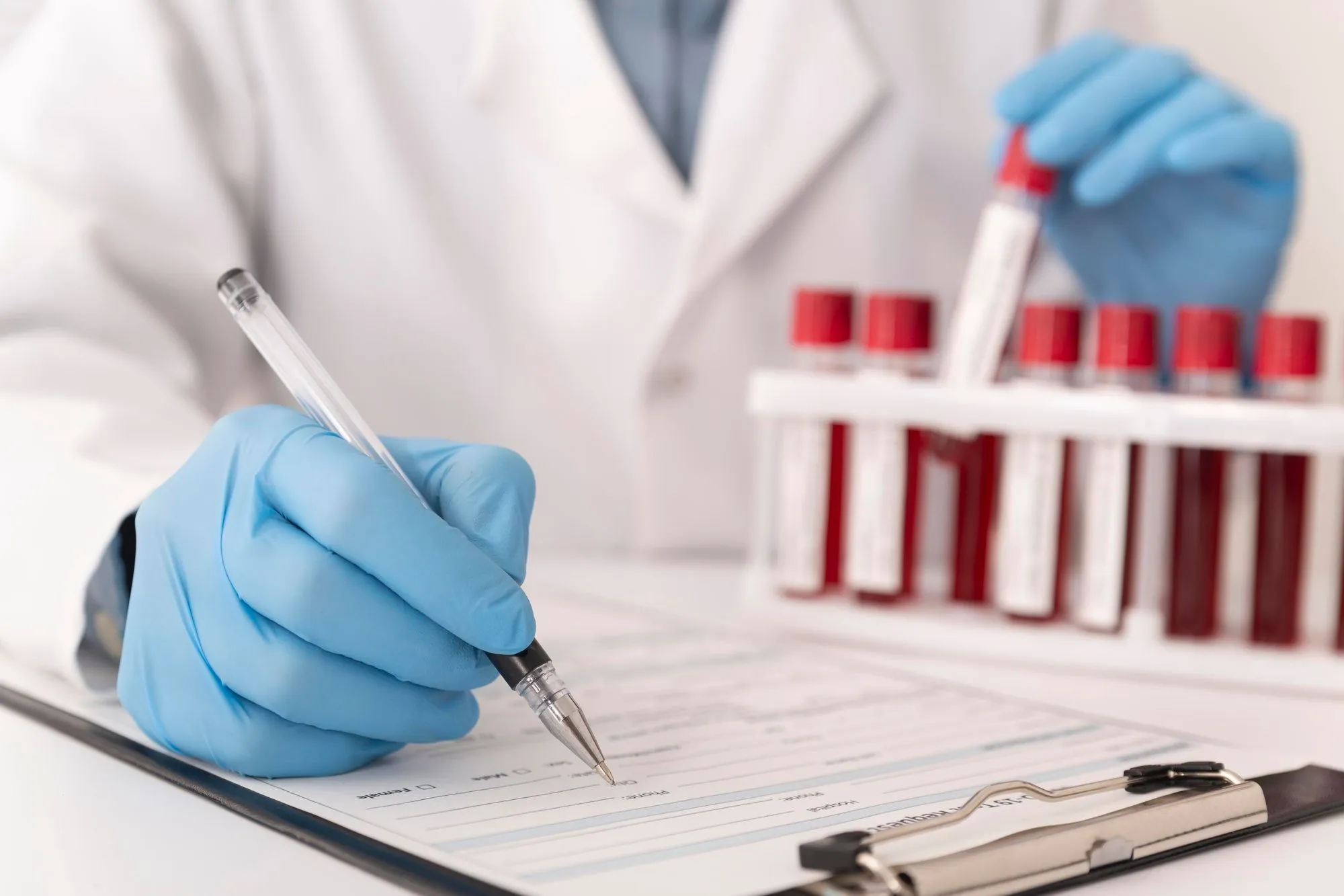 Understanding your fertility results: AMH test, FSH and LH test, estradiol