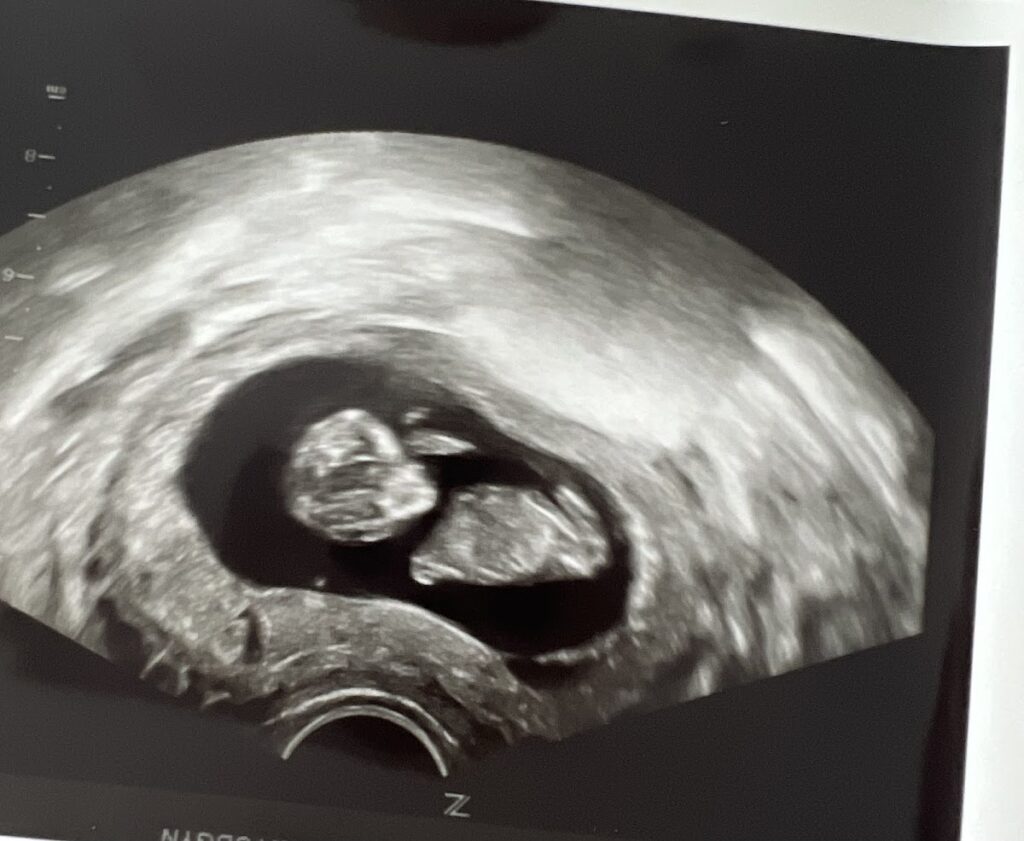 Made in the USA Surrogacy, LLC gallery photo