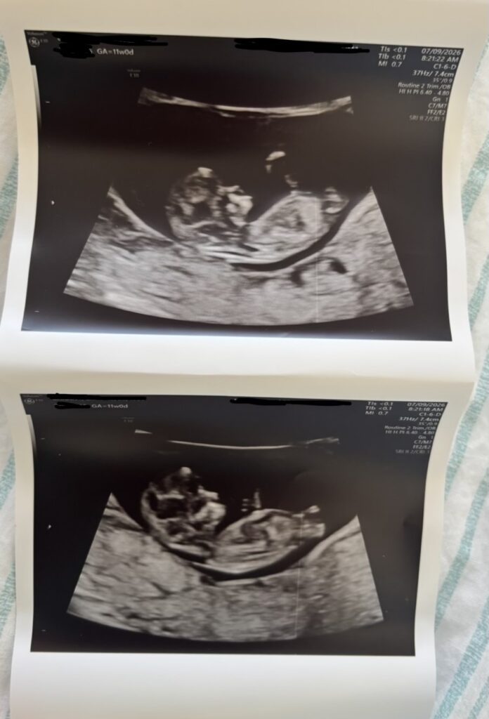 Spring Fertility gallery photo