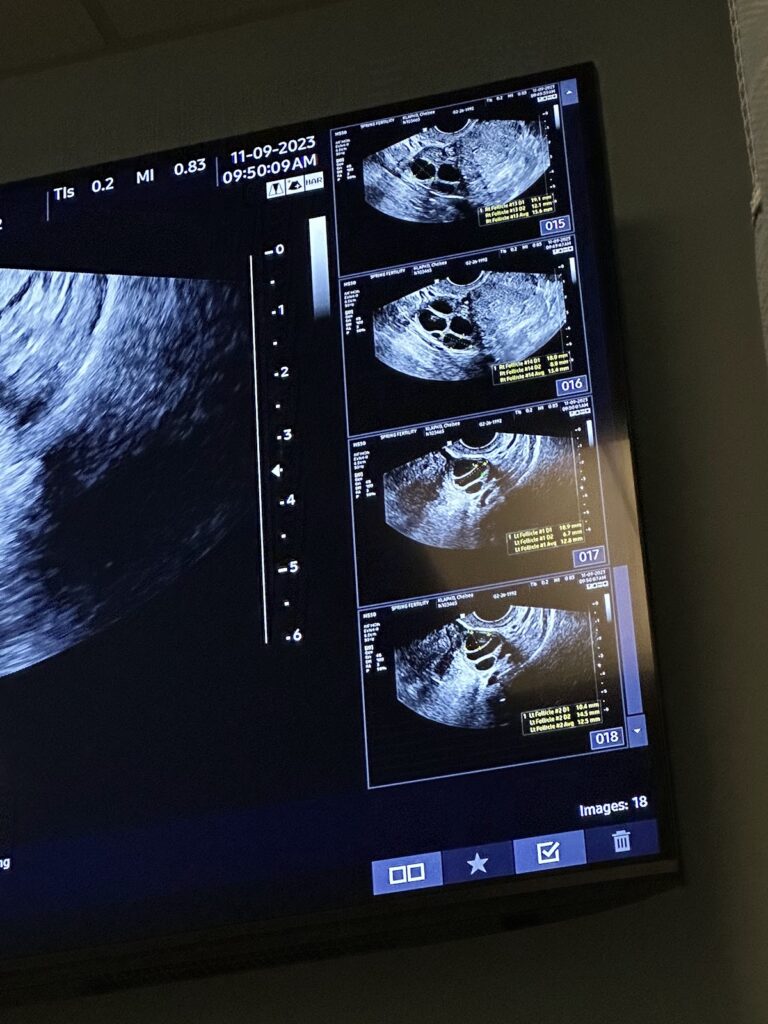 Spring Fertility gallery photo